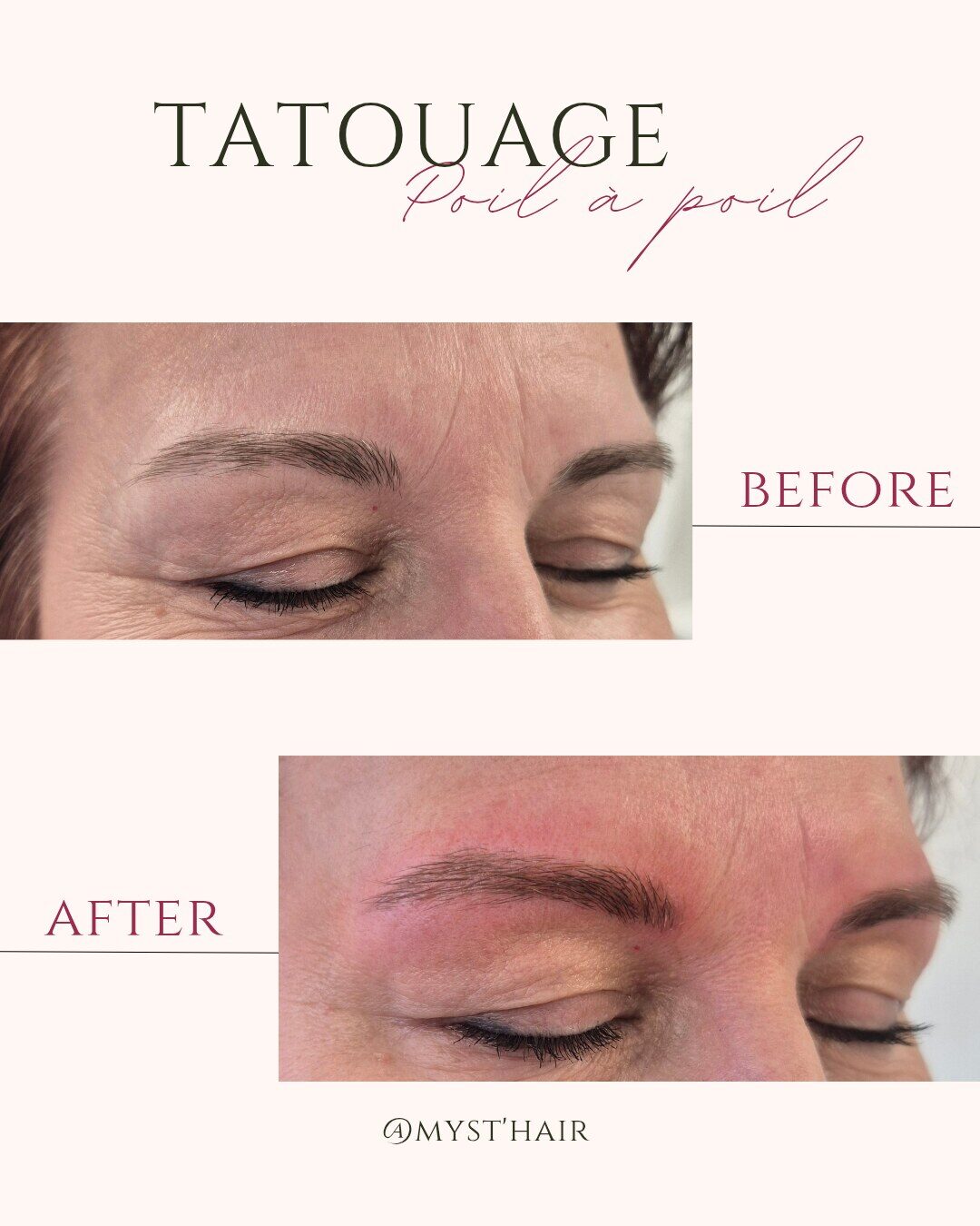 Avant / après d'une dermopigmentation poil à poil chez Myst Hair, de profil : la ligne du sourcil reconstruite