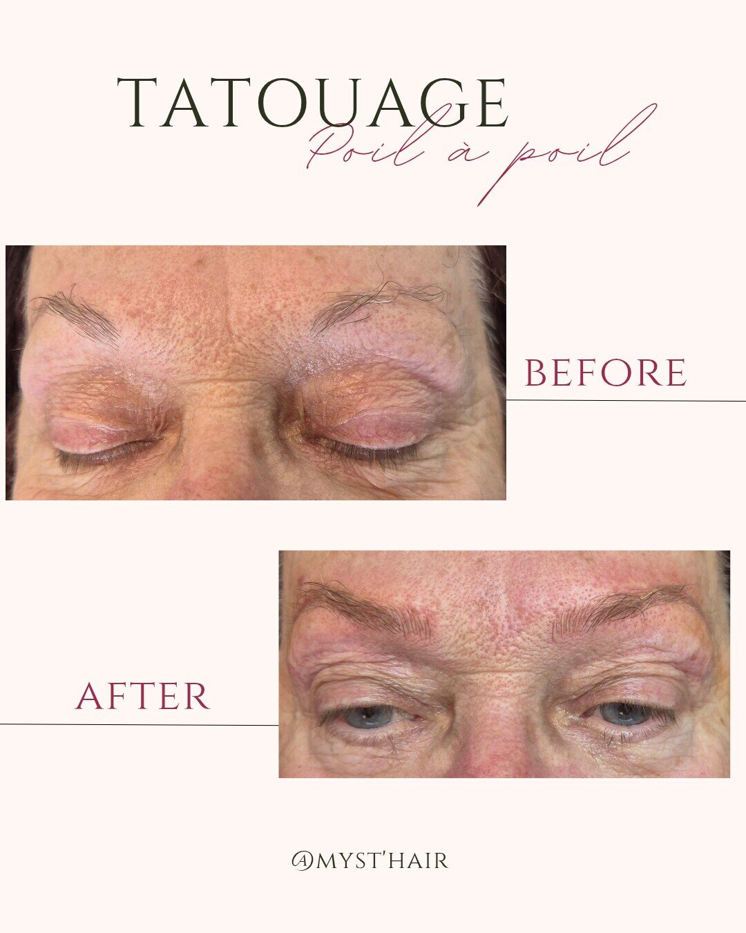 Avant / après d'une dermopigmentation poil à poil réalisée chez Myst Hair : sourcils clairsemés puis redessinés trait par trait