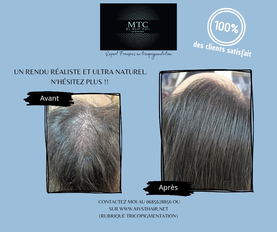 Avant / après d'une densification par tricopigmentation sur cheveux longs : raie clairsemée puis comblée